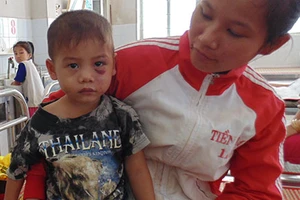 Bé trai ba tuổi bị cha dượng đánh dã man