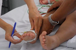 Số mắc tay-chân-miệng gấp bốn lần sởi