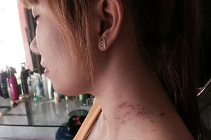 Nữ chủ tiệm chống kẻ cướp cầm dao 