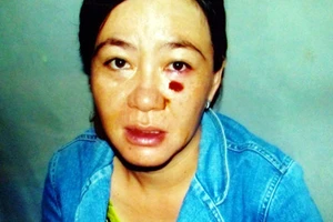 Thi hành án lạm quyền