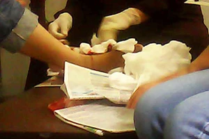 Quái gở chuyện cắt lể… trị u bướu!