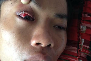 Công an xã bị tố đánh người dập lá lách