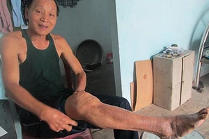 Người cao tuổi đi xe buýt vẫn bị thu tiền