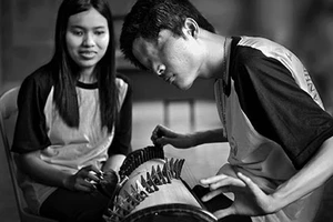 Triển lãm ảnh về nạn nhân chất độc da cam 