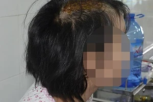 Đòi công lý và an toàn cho cháu bị chém