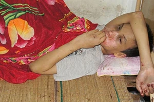 Bé trai khuyết tật bị bắt cóc, đánh đập 