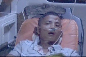 Vượt 350 km với cây cào sắt găm vào đầu