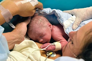 Ca sinh con đầu tiên bằng tử cung ghép