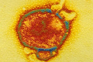 Virus từ dơi có thể gây chết người