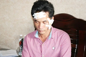 Tổ trưởng bảo vệ dân phố bị tố đánh rách mặt người dân