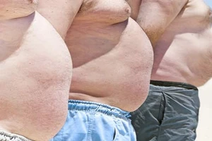 Báo động ung thư vì béo phì