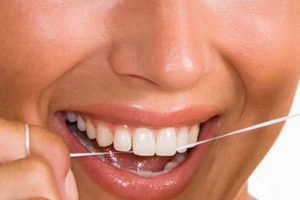 Viêm nha chu chiếm 90% dân số Việt Nam