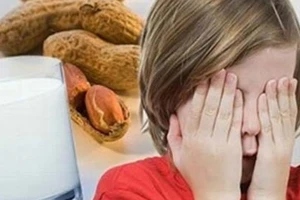 Dị ứng thực phẩm, trị cách nào?