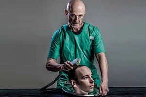 Ghép đầu người: Quái thai - người sắp xuất hiện? 