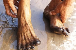 Khảo sát hiện tượng ‘chân đen thui sau lội ruộng’