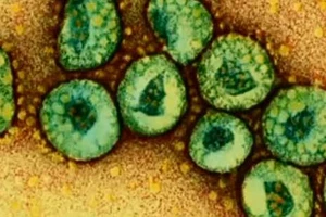 MERS-CoV lây từ người sang người theo cấp số nhân