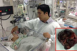 Vừa sinh ra đã mổ lấy u não