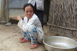 Tìm chồng cho người điên