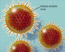 Phát sốt trước cuộc khủng hoảng siêu vi trùng