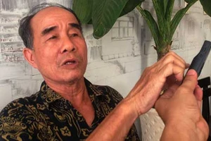 Kiện vì… nhìn một thấy hai