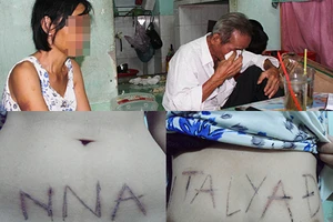 Vì ghen, dùng dao lam xăm cơ thể người tình 