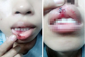 Xác minh clip ‘dập môi vì đòi CSGT giải thích’