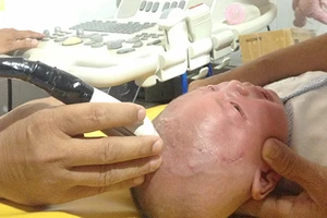 Bé bị dao xuyên não tái khám khỏe mạnh