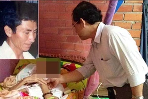 ‘Bệnh lạ ‘ăn’ tới đầu chồng tôi rồi’!