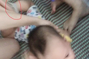 Ba cô giáo trói, đánh, nhét giẻ vào mồm trẻ