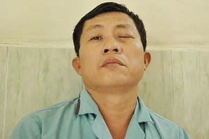 Một bệnh nhân múc bỏ mắt do nhiễm nấm