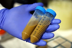 ‘Ngân hàng phân người’ tại Hà Lan