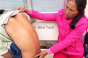 Một em nhỏ nghi bị công an xã đánh nhập viện