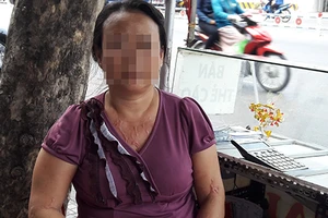 Phải tăng khung phạt với hành vi tạt acid 