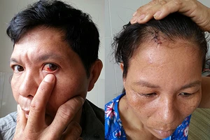 Xô xát, bị dân phòng đánh...