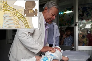 Nguy cơ trẻ bị liệt cánh tay sau sinh