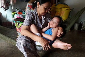 Mất trí nhớ do virus viêm não tấn công