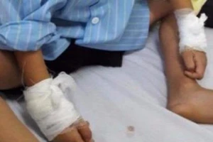 Đình chỉ công tác bác sĩ mổ nhầm từ tay phải sang tay trái