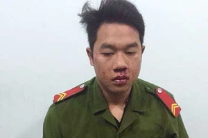 Rộ nạn giả danh công an ở Đồng Nai