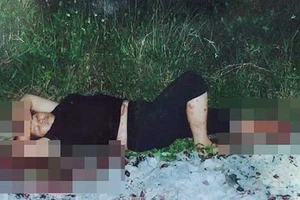 Cần khởi tố vụ thuê người chặt tay, chân để lừa bảo hiểm?