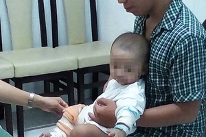 Sơ cứu sai cách, trẻ phỏng nhẹ thành nặng 