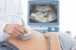 TP.HCM khẩn cấp đối phó với dịch Zika