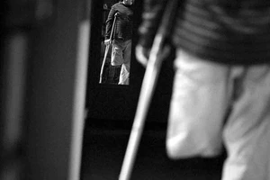 Rối loạn nhận dạng cơ thể - bệnh kinh dị