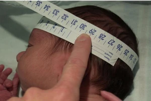 TP.HCM chưa phát hiện sơ sinh dị tật đầu nhỏ do Zika