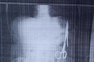 Kéo mà ‘chui’ bụng bệnh nhân được thì bó tay!