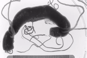 Coi chừng lây giun đũa chó từ thú cưng