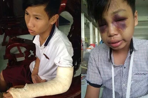 Điều tra vụ công an xã bị tố đánh chết học sinh