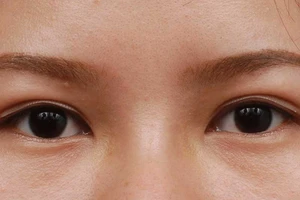 Đủ thứ mối nguy khi mắt ‘biểu tình’