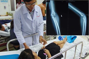 Bó thuốc Nam, coi chừng tay trẻ bị biến dạng 