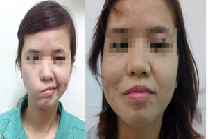 Cô gái 20 năm mới dám cười