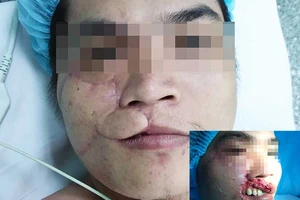 Mang lại tự tin cho gương mặt biến dạng 